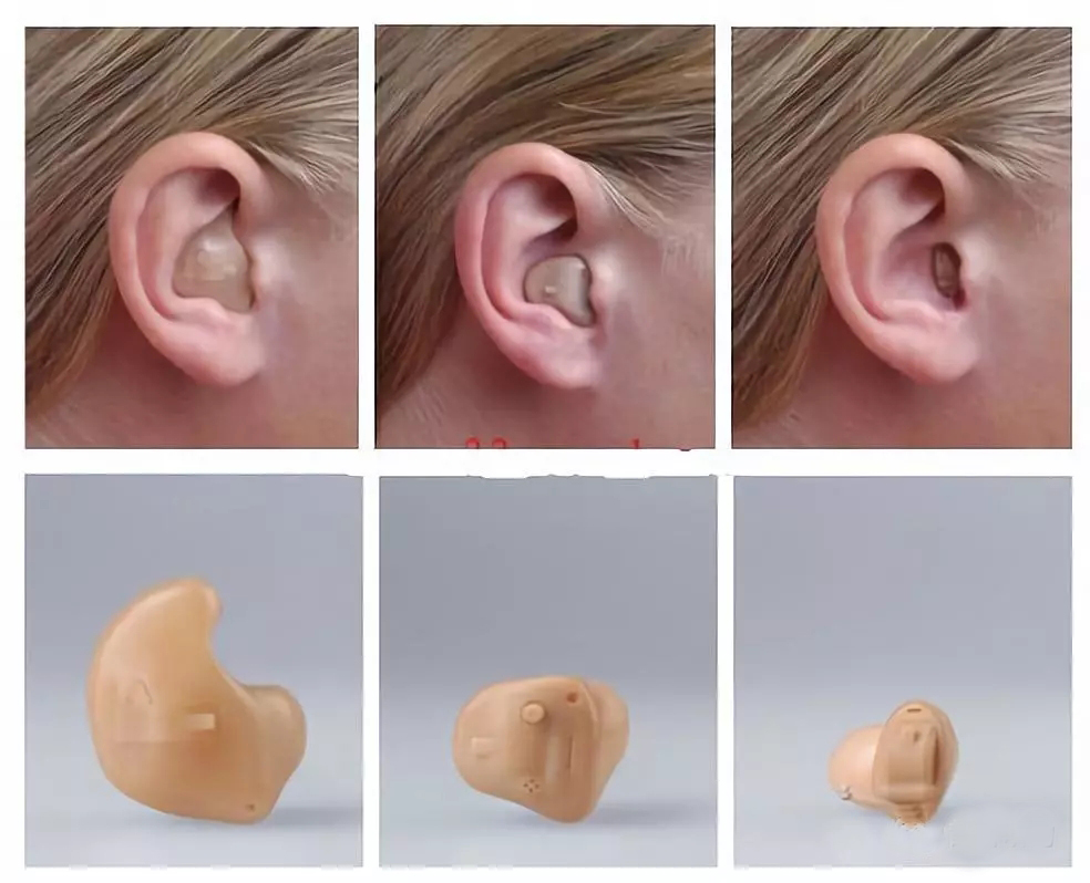 老人可以配隐形助听器吗